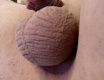 Small hypospadia babydick