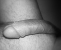 Dick