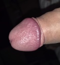 penis