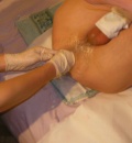 eroticke FIST