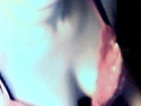 webka
