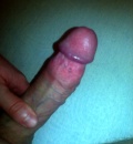 penis