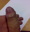 penis
