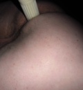 anal