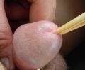 Strky