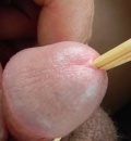Strky