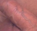 123