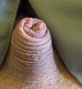 small dick :)