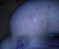 vana