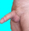 Chlupatý
