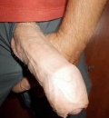 Mrdprc
