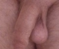 penis